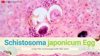 Schistosoma japonicum egg in liver under the microscope with Haematoxylin and Eosin HampE stain [upl. by Marylynne]