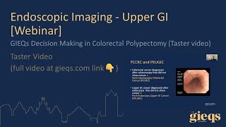 GIEQs Decision Making in Colorectal Polypectomy Taster video [upl. by Ardnazil]