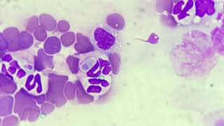 Hepatazoon canis in blood smear [upl. by O'Donoghue254]