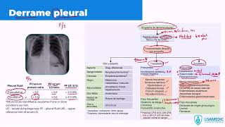 PRIMING 202425  NEUMOLOGÍA DERRAME PLEURAL [upl. by Alon413]