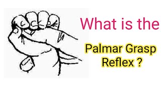 What is Palmar Grasp Reflex  Primitive reflex  Newborn reflex [upl. by Hanzelin]