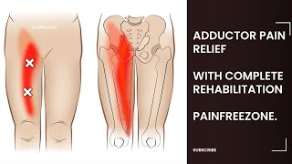 Groin painadductor strainpain reliefrehabilitation PAINFREEZONE [upl. by Dag]