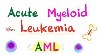 Acute Myeloid Leukemia AML  Auer Rods  Myeloperoxidase Positive  Hematology amp Oncology Series [upl. by Nazay]