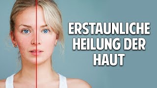 Probleme mit der Haut Erstaunliche Heilung durch natürliche Kosmetik [upl. by Jaclin]