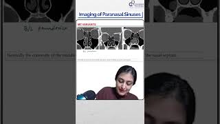 Dr Zainab Vora Explains Imaging of Paranasal Sinuses  Conceptual Radiology [upl. by Enovahs862]