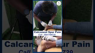 Calcaneal Spur Pain treatment  DrVijay Non Surgical  Chiropractic Treatment [upl. by Lucania117]