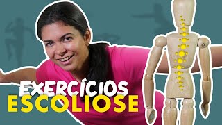 ESCOLIOSE  Exercícios para fazer em casa [upl. by Elizabeth711]