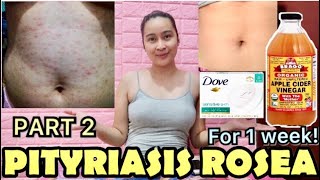 PITYRIASIS ROSEA WHAT’S MY STORY PHILIPPINES [upl. by Donavon466]