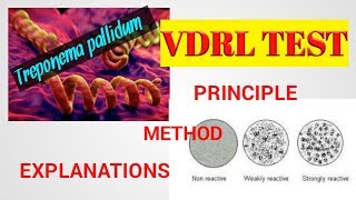 VDRL TestVDRL test procedureTreponema pallidum Microbilogysyphilis testSTDSTAR LABORATORY [upl. by Atinit302]