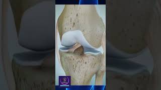 ACL Injuries shorts education [upl. by Shelbi10]