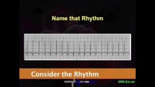 Intro EKG Interpretation Part 2 [upl. by Catarina]