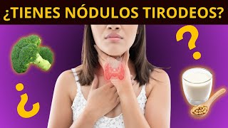 ¿TIENES NÓDULOS TIROIDEOS síntomas diagnóstico y tratamiento [upl. by Ahsimrac]