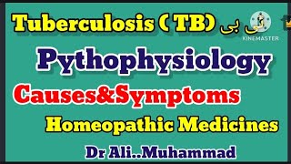 Tuberculosis TB causesampsymptoms treatment by homeopathic medicinesdr ali muhammad sahib [upl. by Roldan]