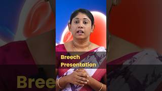 Breech presentation pregnancytips normaldelivery baby drsavitha udumalpet [upl. by Styles]