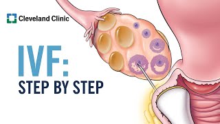 How Does In Vitro Fertilization IVF Work A StepbyStep Explanation [upl. by Natehc]