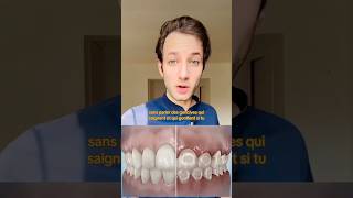 LA VERITÉ SUR LES TACHES APRÈS LES BAGUES DENTAIRES  🦷 dentiste orthodontie appareildentaire [upl. by Kissel]