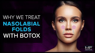 Using BOTOX® To Treat Nasolabial Folds at Mabrie Facial Institute [upl. by Roper]