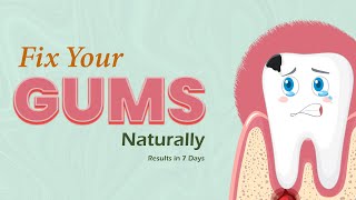 quotTransform Your Gums in 7 Days – No Dentist Neededquot [upl. by Griffie109]