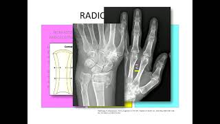 Imaging of Osteoporosis [upl. by Sully183]