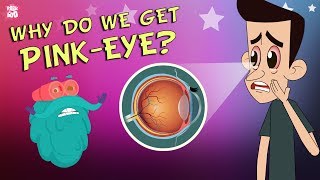 What Causes Conjunctivitis  CONJUNCTIVITIS  PinkEye  The Dr Binocs Show  Peekaboo Kidz [upl. by Mattox]