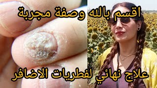 علاج طبيعي لفطريات الاظافر mycose des ongles بسرعة متنسايش دعي معايا بعد الوصفة [upl. by Iztim989]