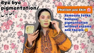 Melasma ka ilaj  Chehre ki Chaiyoon ka illaj  remove pigmentation [upl. by Annyl]