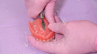 SOFRELINER TOUGH® Tips amp Tricks – Preparing the Denture Surface [upl. by Maiga586]