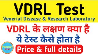 VDRL टेस्ट क्या होता है  VDRL test in hindi  Venerial Disease Research Laboratory Test [upl. by Sorci]