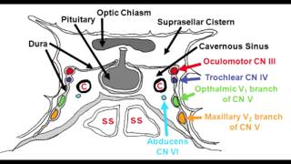 Cavernous Sinus Anatomy amp Cavernous Sinus Syndrome [upl. by Karr]