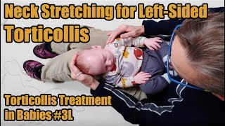 3L Neck Stretches for Leftsided Torticollis Torticollis Treatment in Babies [upl. by Aiz430]