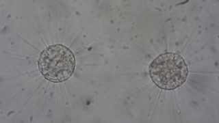 Actinophrys sol Time Lapse of protozoan binary fission [upl. by Kcitrap]