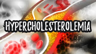 Hypercholesterolemia High Cholesterol  CRASH Medical Review Series [upl. by Ativak]