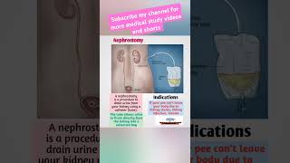 NephrostomyFreeMedicalEducationld3sfnursingmedicalviralviralshortsvideoyoutubeviralshorts [upl. by Wallache]