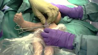 Delayed Cord Clamping [upl. by Airekat348]