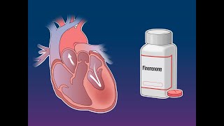 Finerenone in Heart Failure with Preserved Ejection Fraction  NEJM [upl. by Anaya]