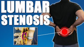 LUMBAR SPINAL STENOSIS BEST Exercises Stretches amp Advice for Back amp Leg Pain Relief [upl. by Ellednahc]