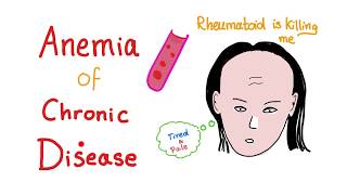 Anemia of Chronic Disease  Anemia of Inflammation All you need to know  Hematology Series [upl. by Emelen]