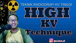 69 High KV Technique Teknik KV Tinggi [upl. by Sonni]