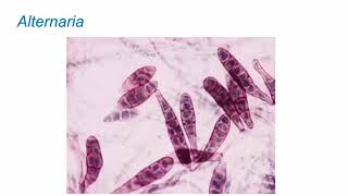 Identification of Melanized Dermatitiaceous Fungi Part 2 Hot Topic [upl. by Cerelia]