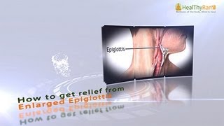 Unbelievable Home Remedy For Swollen Epiglottis You Must Try [upl. by Marras]