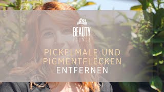 dm BEAUTY LOUNGE  Pickelmale und Pigmentflecken entfernen [upl. by Mik]