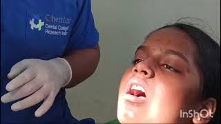 Pediatric dentistry A knowledge video of administration of local anesthesia in children [upl. by Hartley]