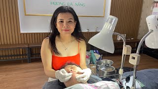 Acne treatment Hương Đà Nẵng đang phát trực tiếp live 2024 [upl. by Nair]