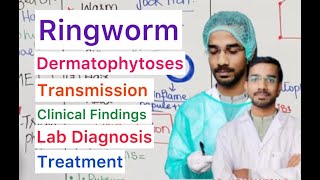 Ringworm  Dermatophytoses  Properties  Clinical  Transmission  Treatment [upl. by Biancha]