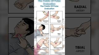 Sits of pulse palpate hospital medicalviralvideo ytshorts trending youtubeshorts youtube [upl. by Odicalp]