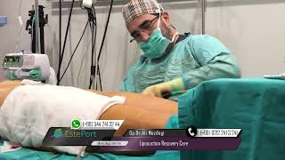 Liposuction Recovery Care [upl. by Leizar]