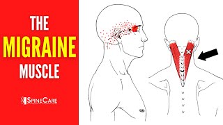 How to Release Tension for FAST MIGRAINE RELIEF [upl. by Tletski]