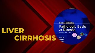 Liver cirrhosis  Causes  Pathophysiology  Morphology  Staging of cirrhosis  Clinical features [upl. by Nicram]