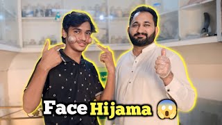 Hijama Cupping Karali Face Per 😱  Hijama Vlog 😍  Wet Cupping Therapy 🥴 [upl. by Yecad]