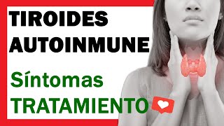 Tiroides Autoinmune o Tiroiditis de Hashimoto SINTOMAS y TRATAMIENTO ✅ [upl. by Anan]